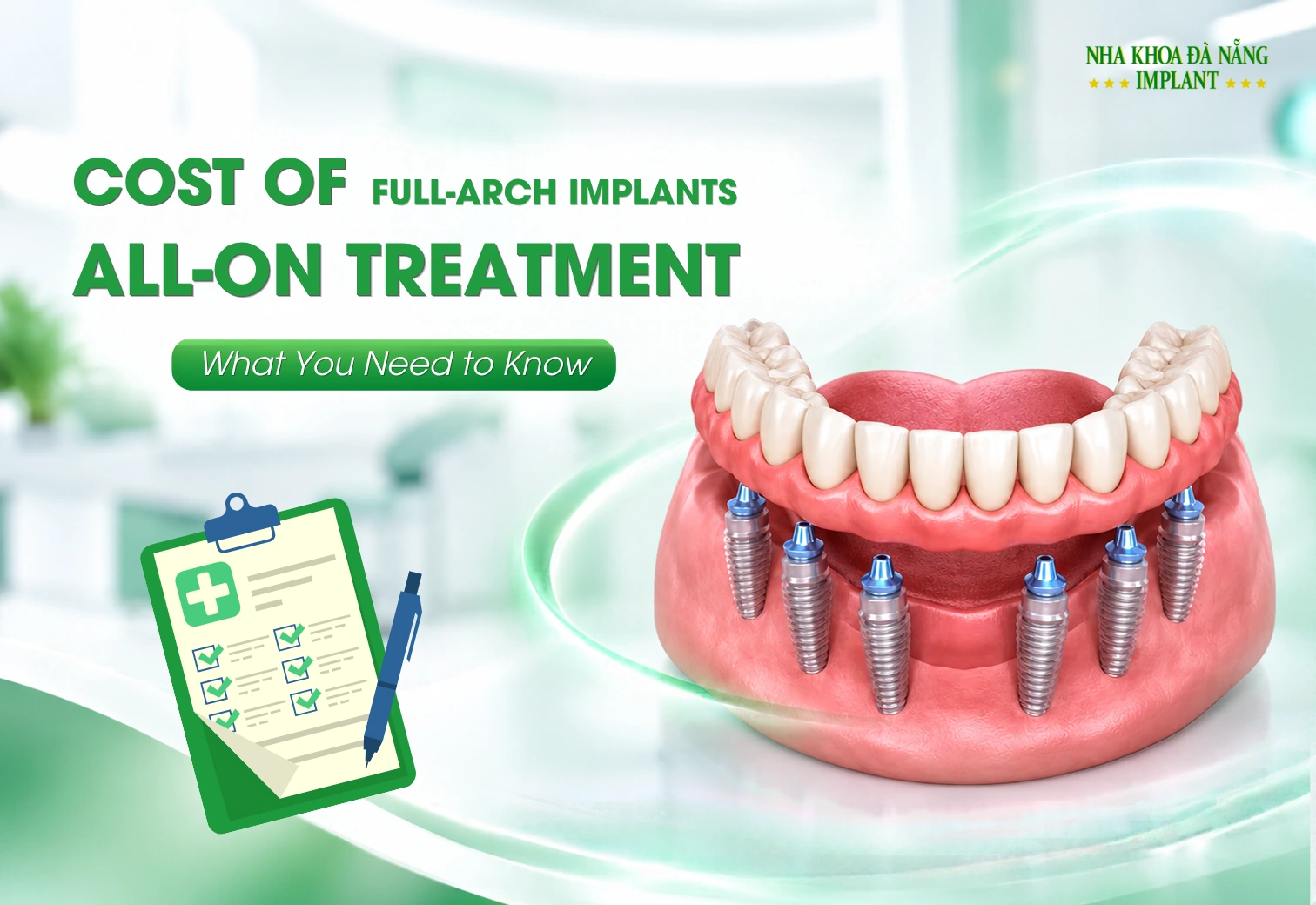 Full-Arch Dental Implants: What Costs Should You Know?