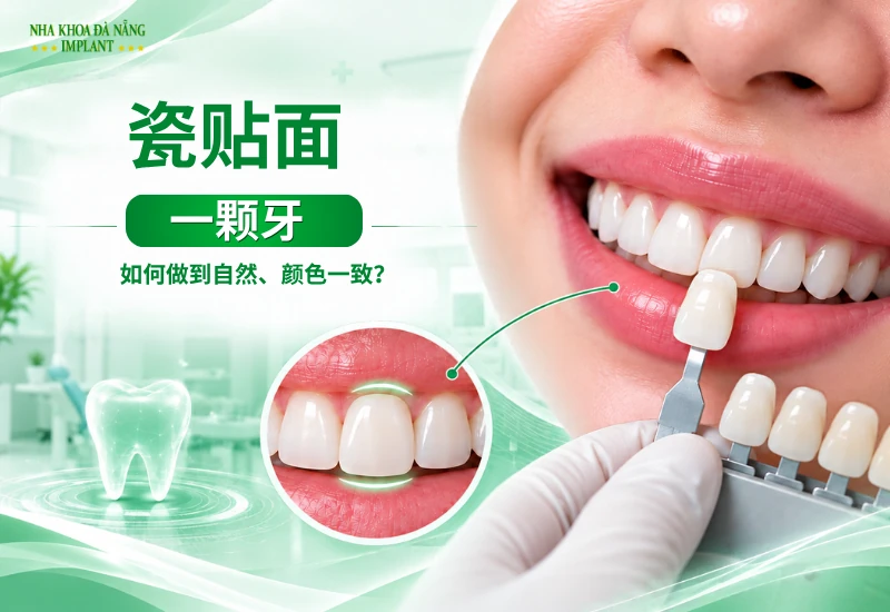 单颗牙齿做牙冠：如何与邻牙自然协调？