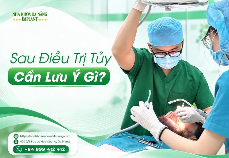 Sau Điều Trị Tủy Cần Lưu Ý Gì? Chăm Sóc Đúng Cách Để Giữ Răng Lâu Dài