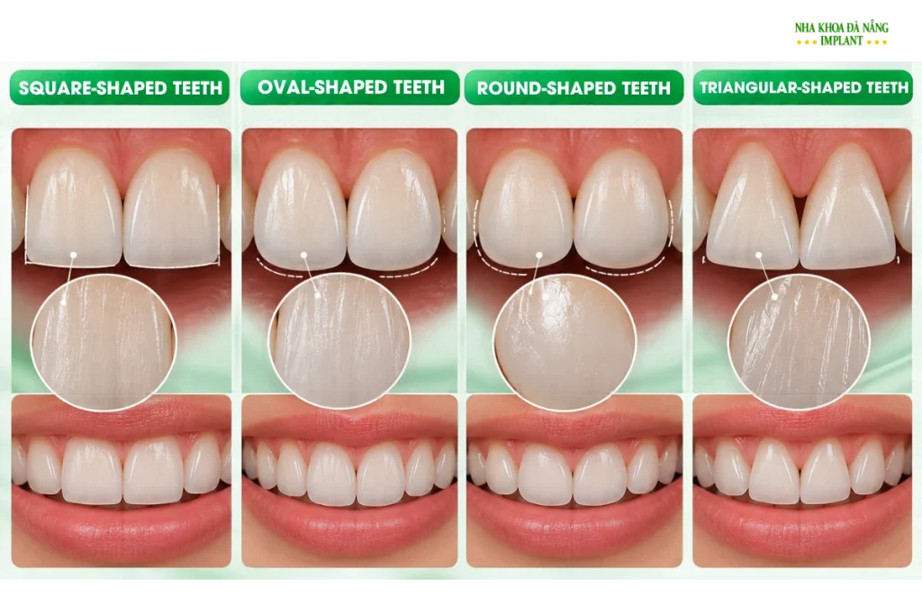Single-Tooth Dental Crown: How Can It Look Natural and Match Your Other Teeth? 11 Tooth Shape, Size, and Surface Texture