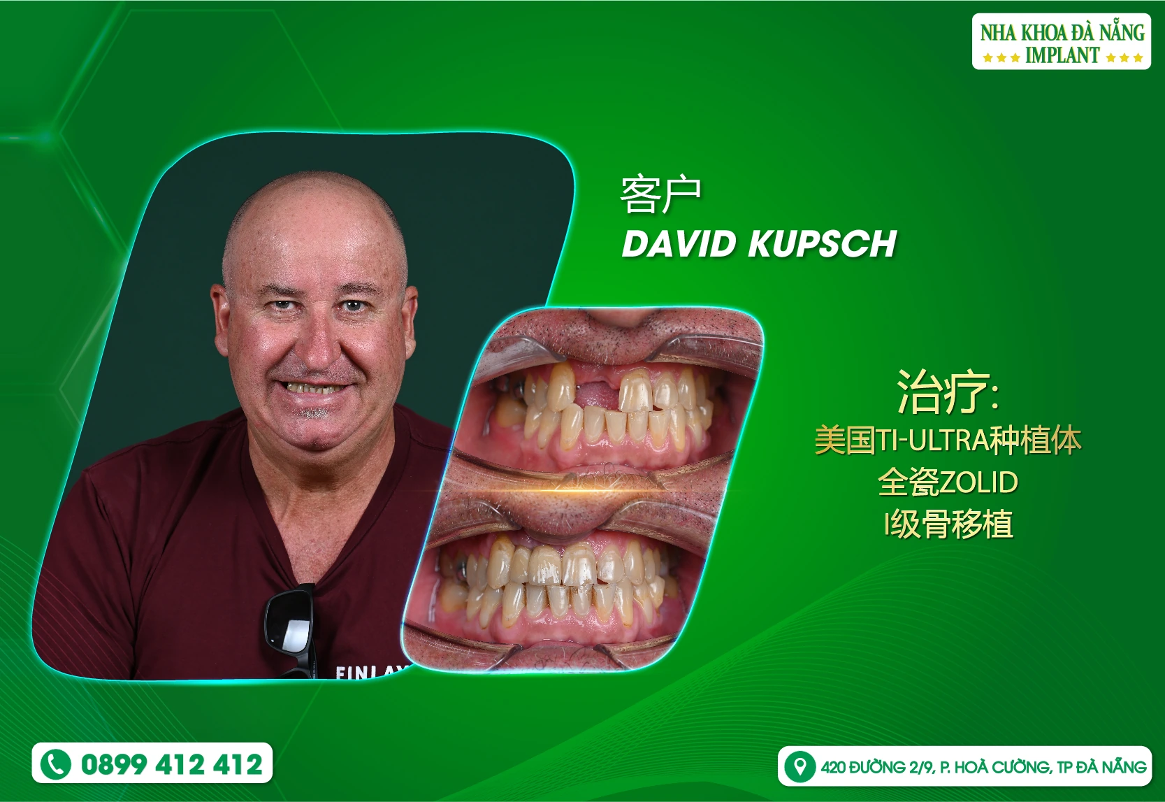 💚 **DAVID先生的笑容修复之旅**