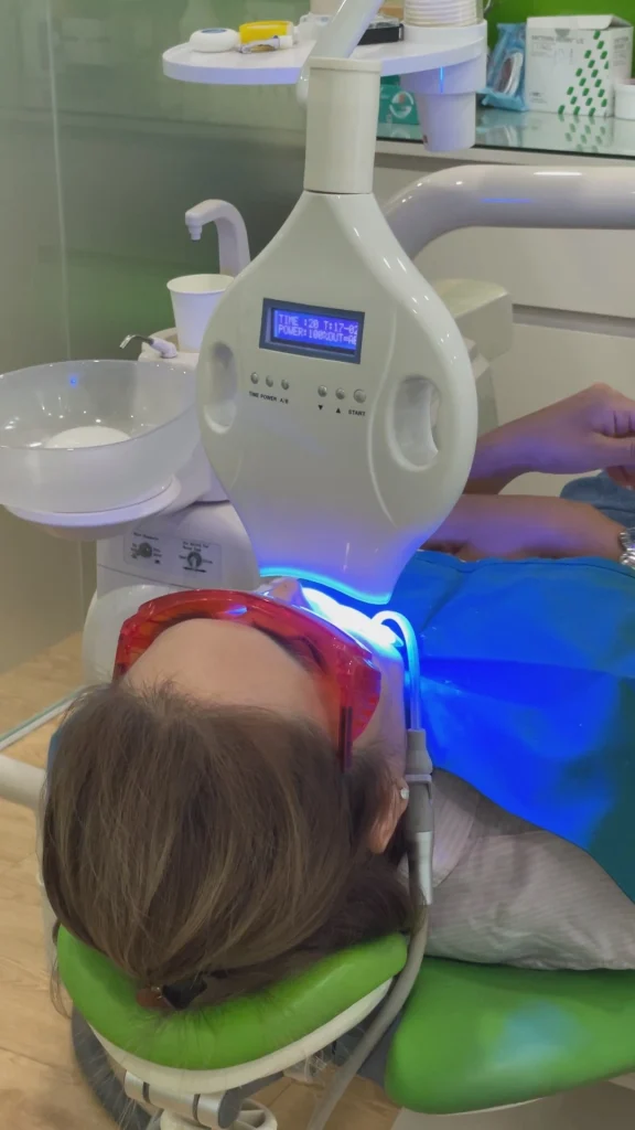 Làm Răng Sứ Một Chiếc: Làm Sao Để Hài Hòa Với Các Răng Bên Cạnh? 13 Tẩy trắng răng tại Nha Khoa Đà Nẵng Implant
