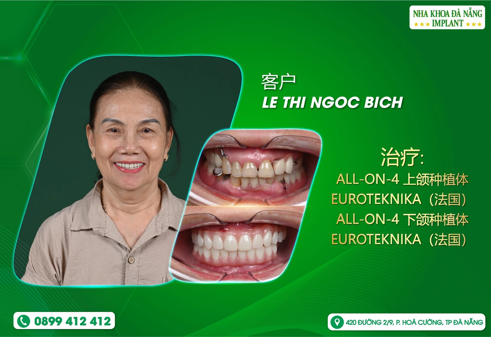 💚 **从顺化到岘港——Bích女士重拾享受美食的快乐**