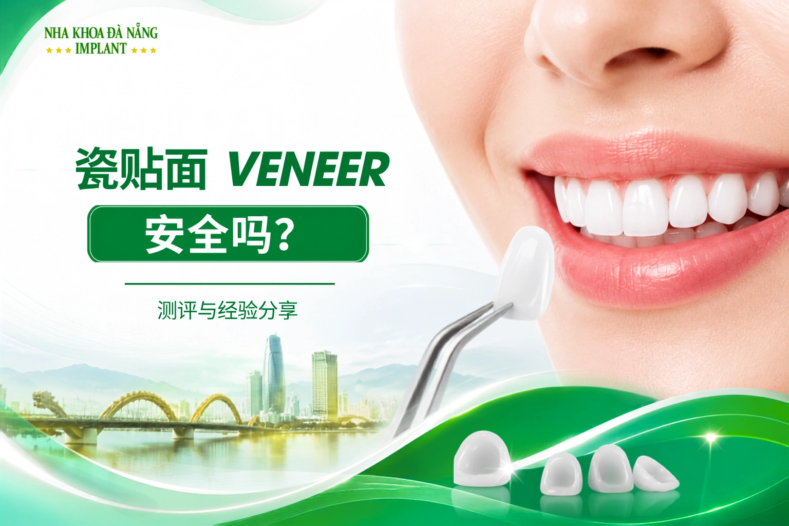 牙贴面安全吗？真实评价与体验分享