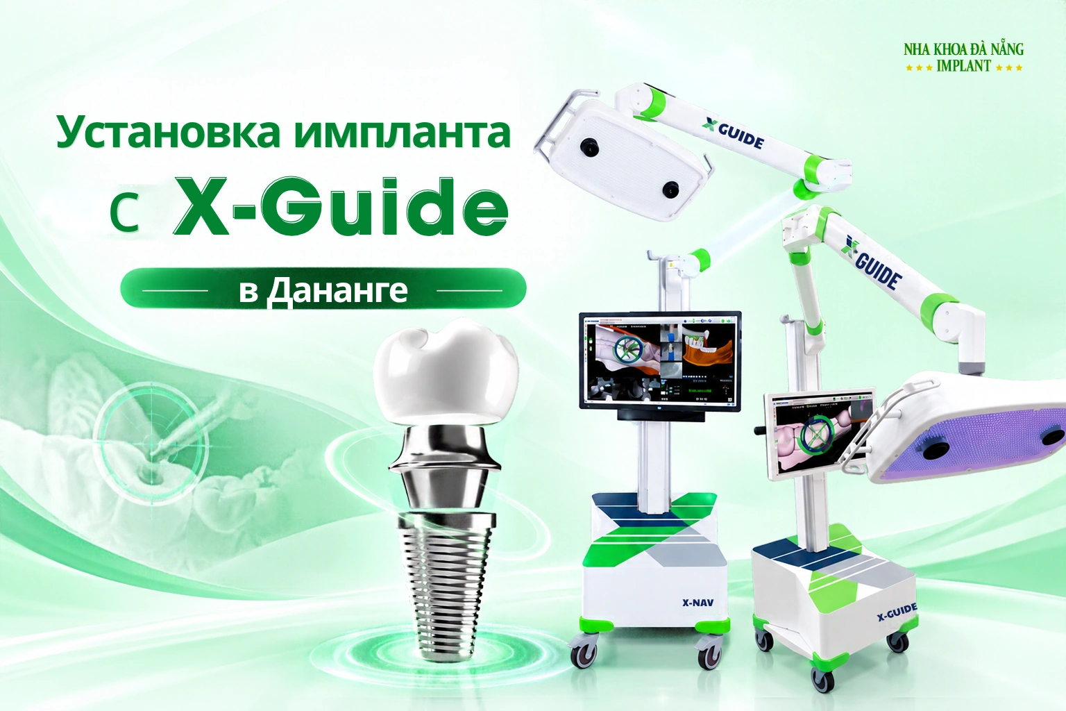 Имплантация Зубов С X-Guide В Дананге: Роль Технологии