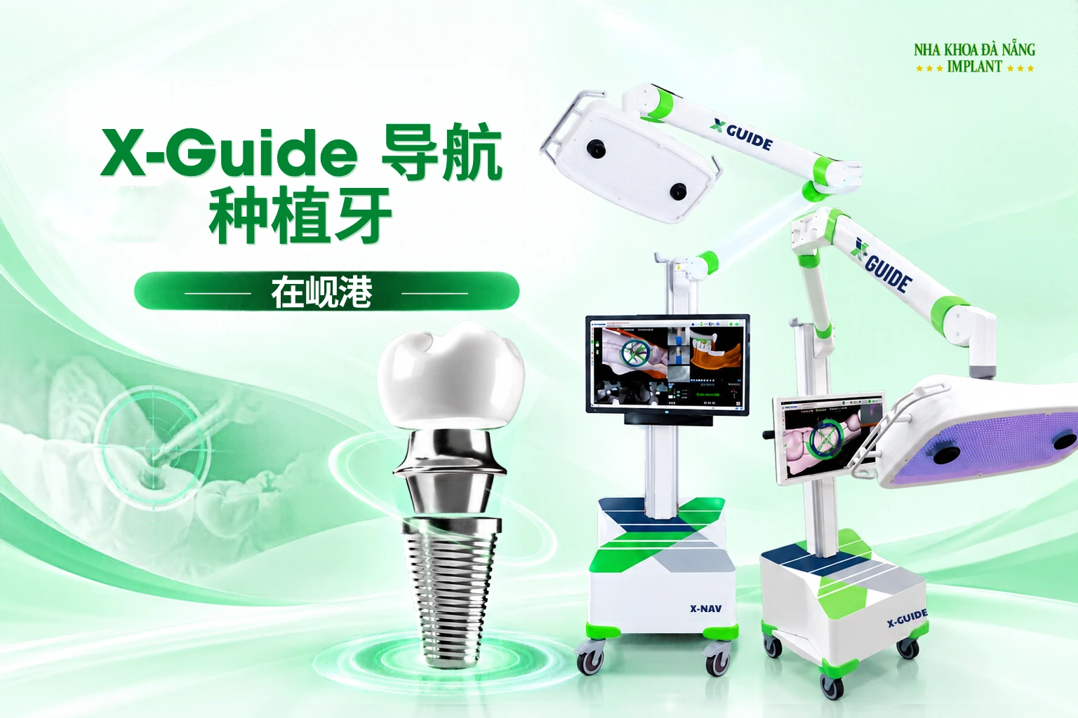 岘港X-Guide辅助种植牙：技术的作用