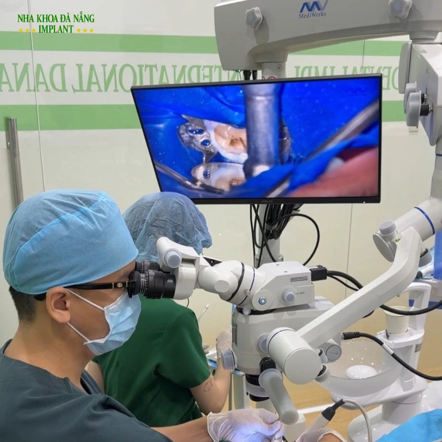 Điều Trị Tủy Dưới Kính Hiển Vi Tại Đà Nẵng 